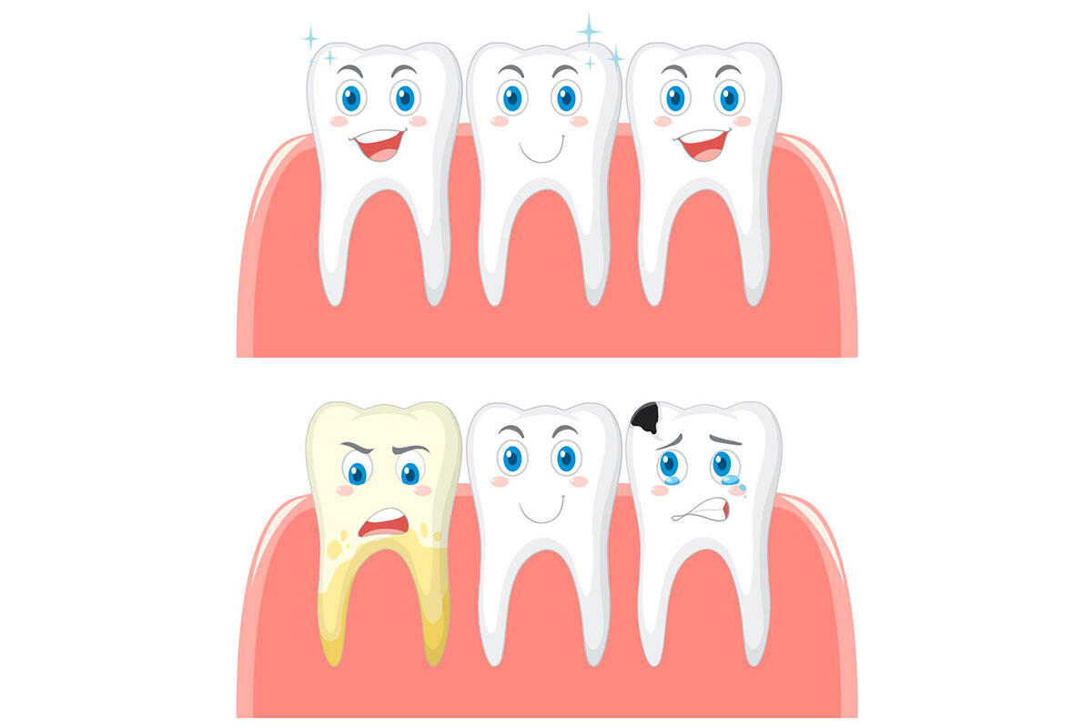 dal-carlo-denti-sani-e-denti-cariati