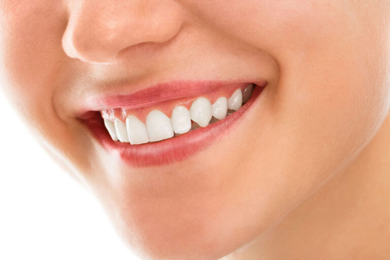 dal-carlo-salute-dentale-sorriso