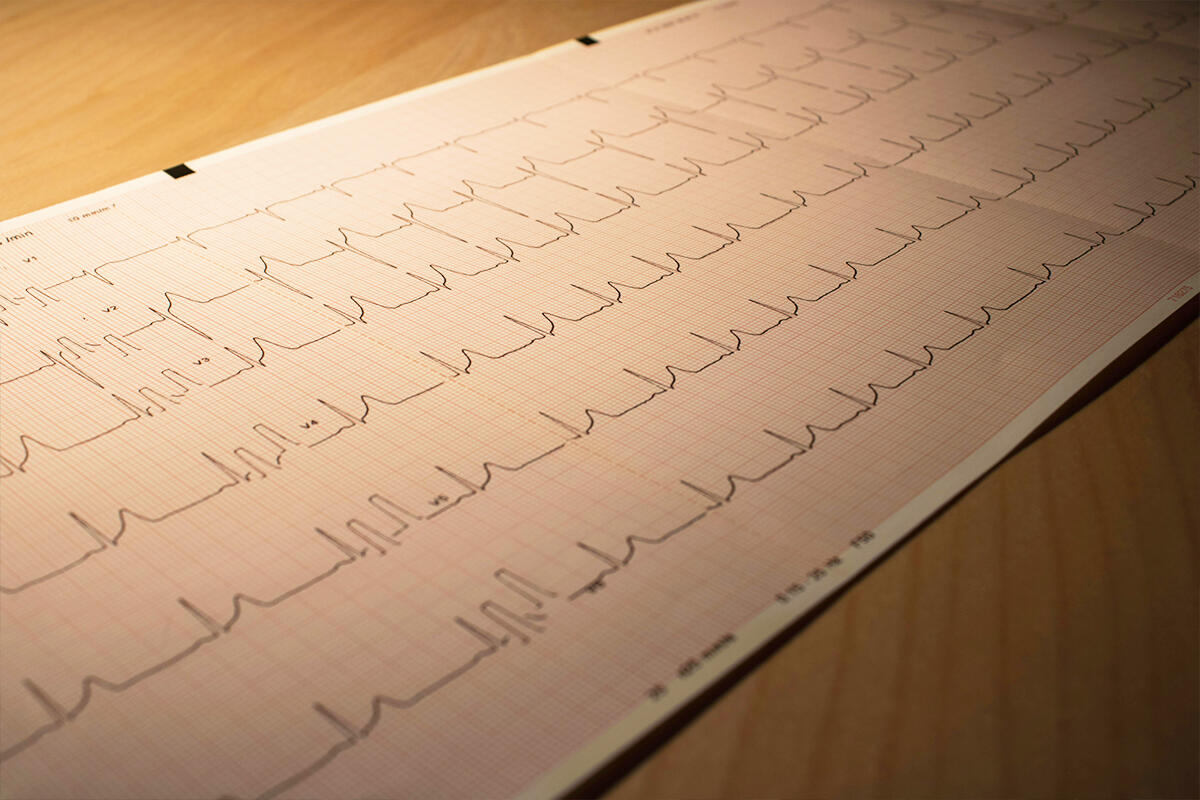 ecodopler-cuore-infarto-miocardio-acuto