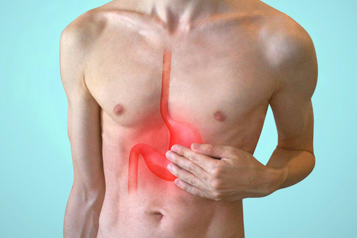 bortoluzzi-bruciore-esofago-reflusso-gastrico