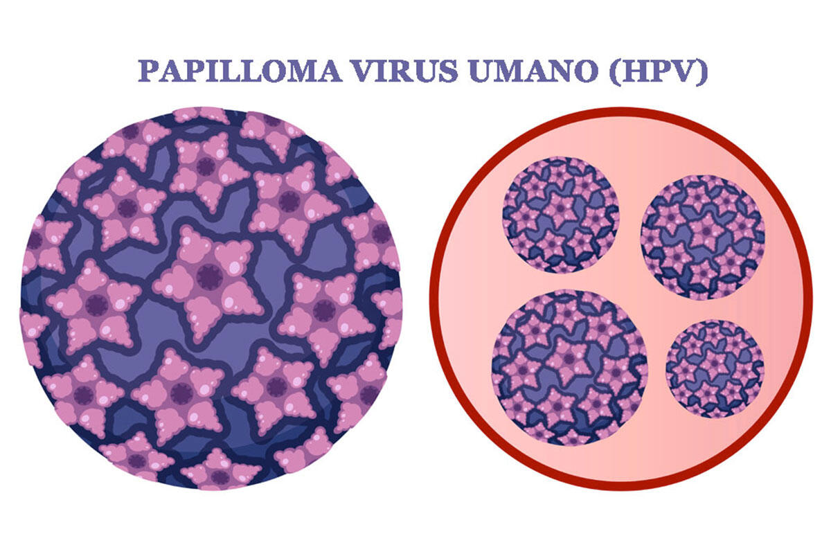 panese-papilloma-virus